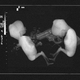 An Albuquerque Police Department ultrasound depicting the fetal fatality.